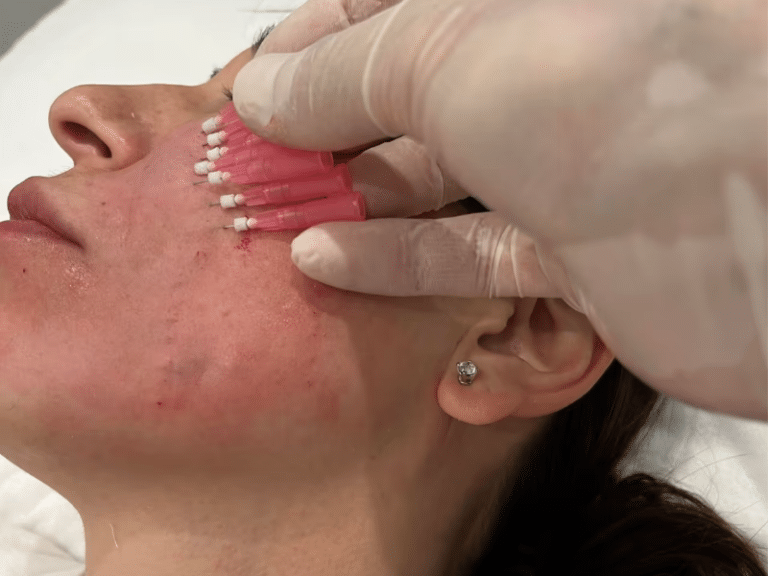 MATRIX PDO mono thread