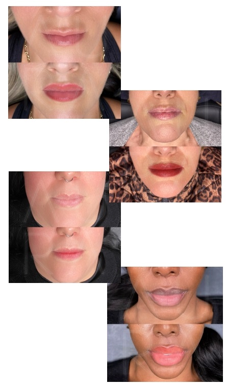 Lip Tattoos - Cosmetic Tattooing Melbourne